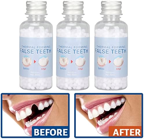 Регулировочный Топчета за ремонт на зъбите, 3 Кутии Временни Топки За Пломбирования Зъби, Пластмасова Термоподборный